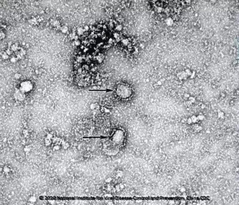 ▲新型冠狀病毒武漢株01。照片來源：國家病原微生物資源庫（中國疾病預防控制中心病毒病預防控制所）